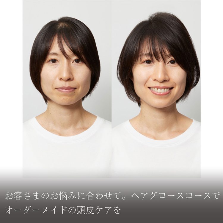 オーダーメイドの施術、ヘアグロースコースでオーダーメイドの頭皮ケアを画像